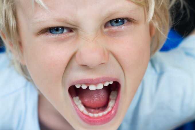 angry-child